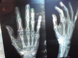 X Ray wallpaper thumb